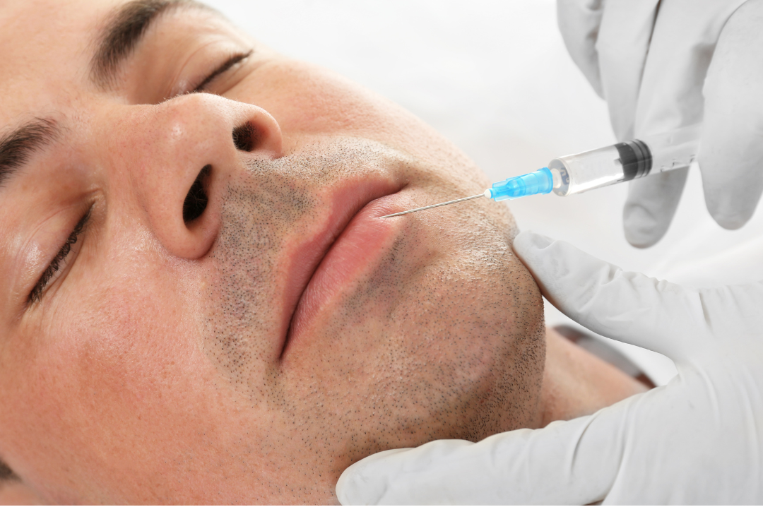 rellenar labios ácido hialurónico