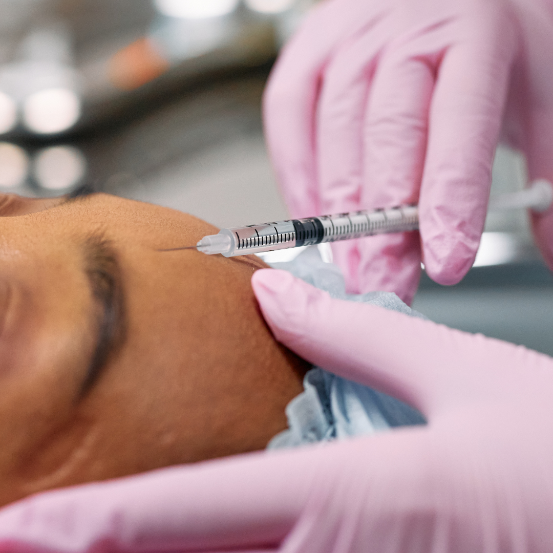 toxina botulínica botox para quitar arrugas