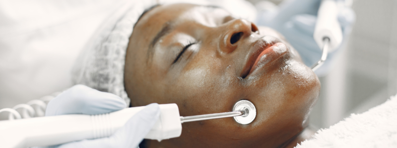 hifu facial Madrid centro