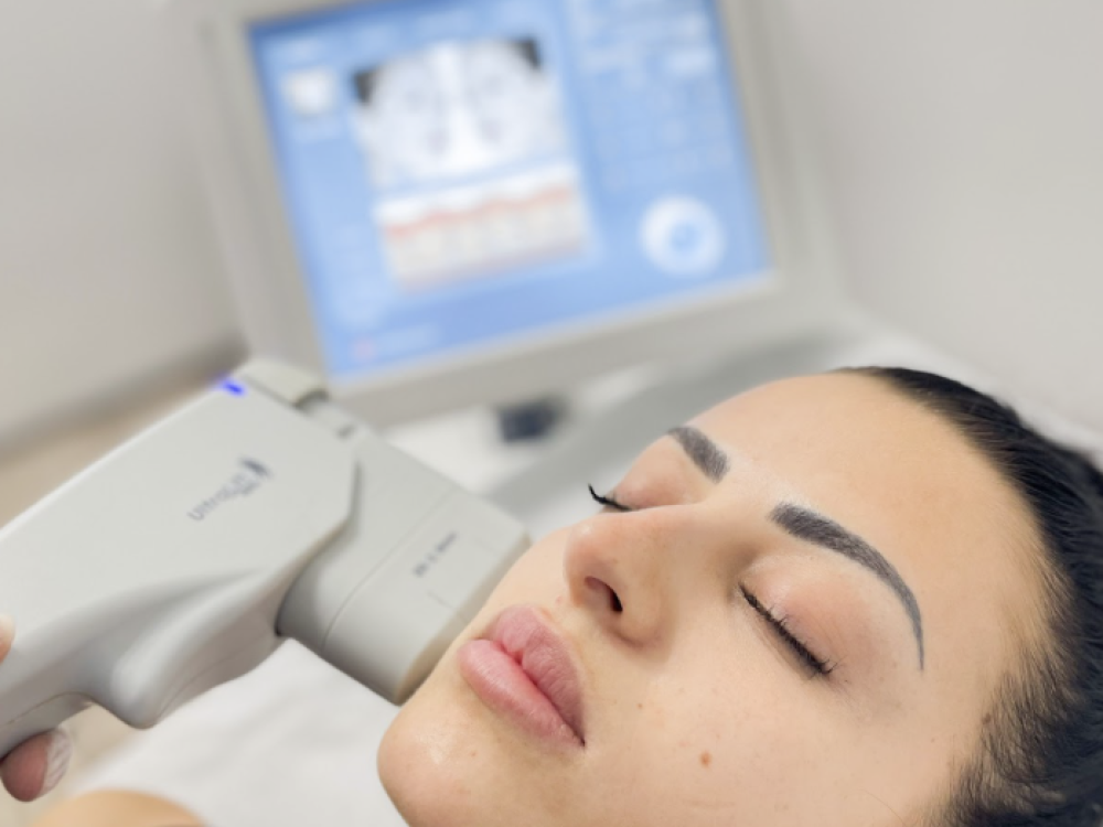 Revolucionando la Medicina Estética con HIFU: Una Guía Completa del Innovador Tratamiento HIFU
